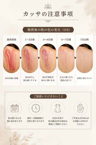カッサさんの写真