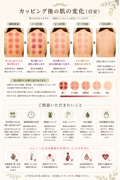 カッピングさんの写真